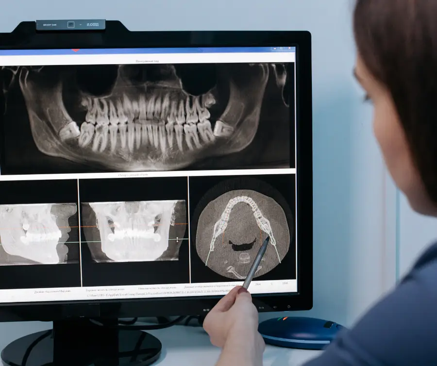 Panoramica dentale e Cone Beam 3D sul monitor di refertazione