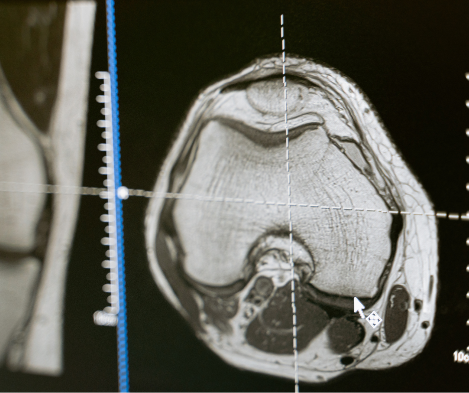 Dettaglio tecnico gantry e componentistica interna scanner TAC ricondizionato